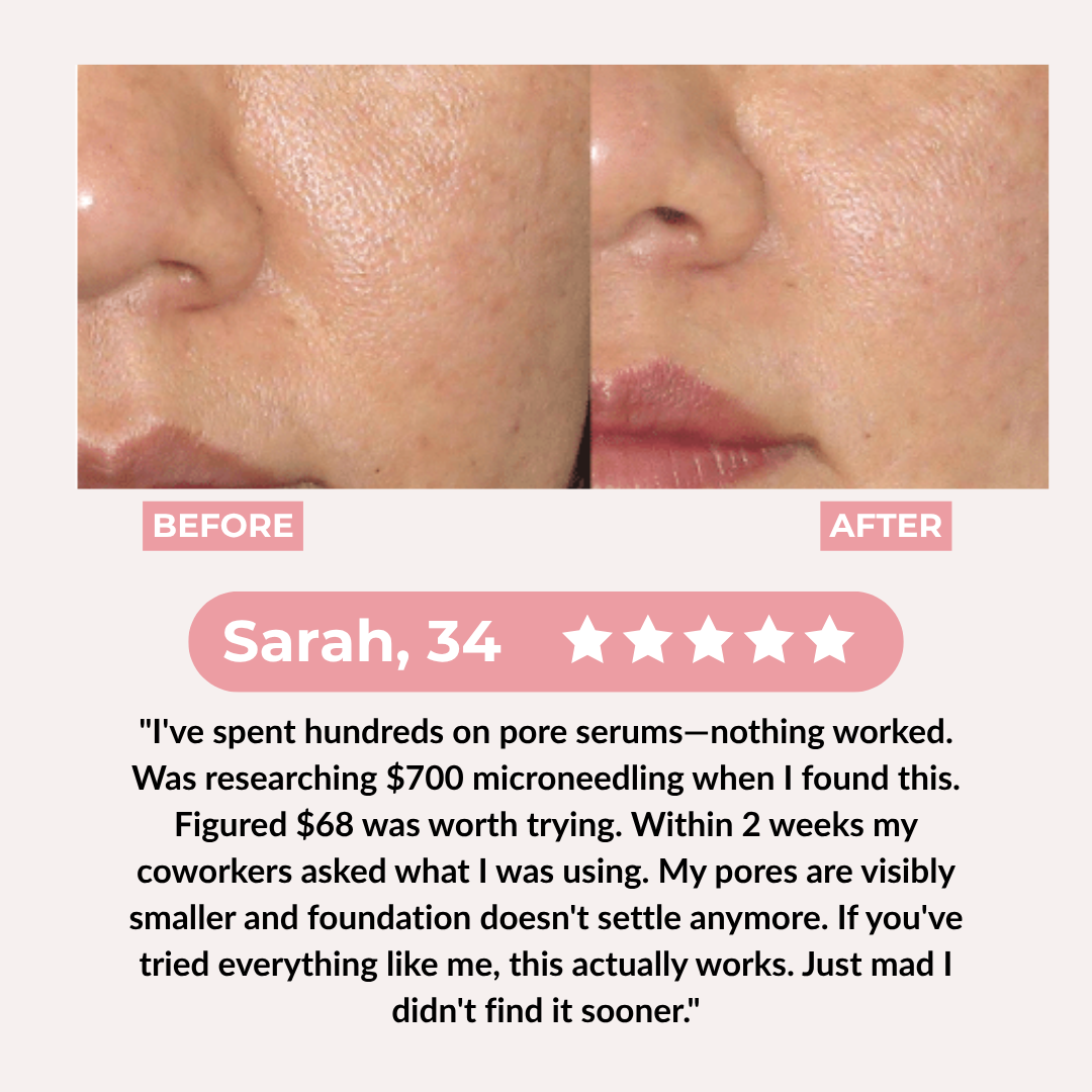 PDRN Pink Collagen Exosome Shot Anti Pores Serum