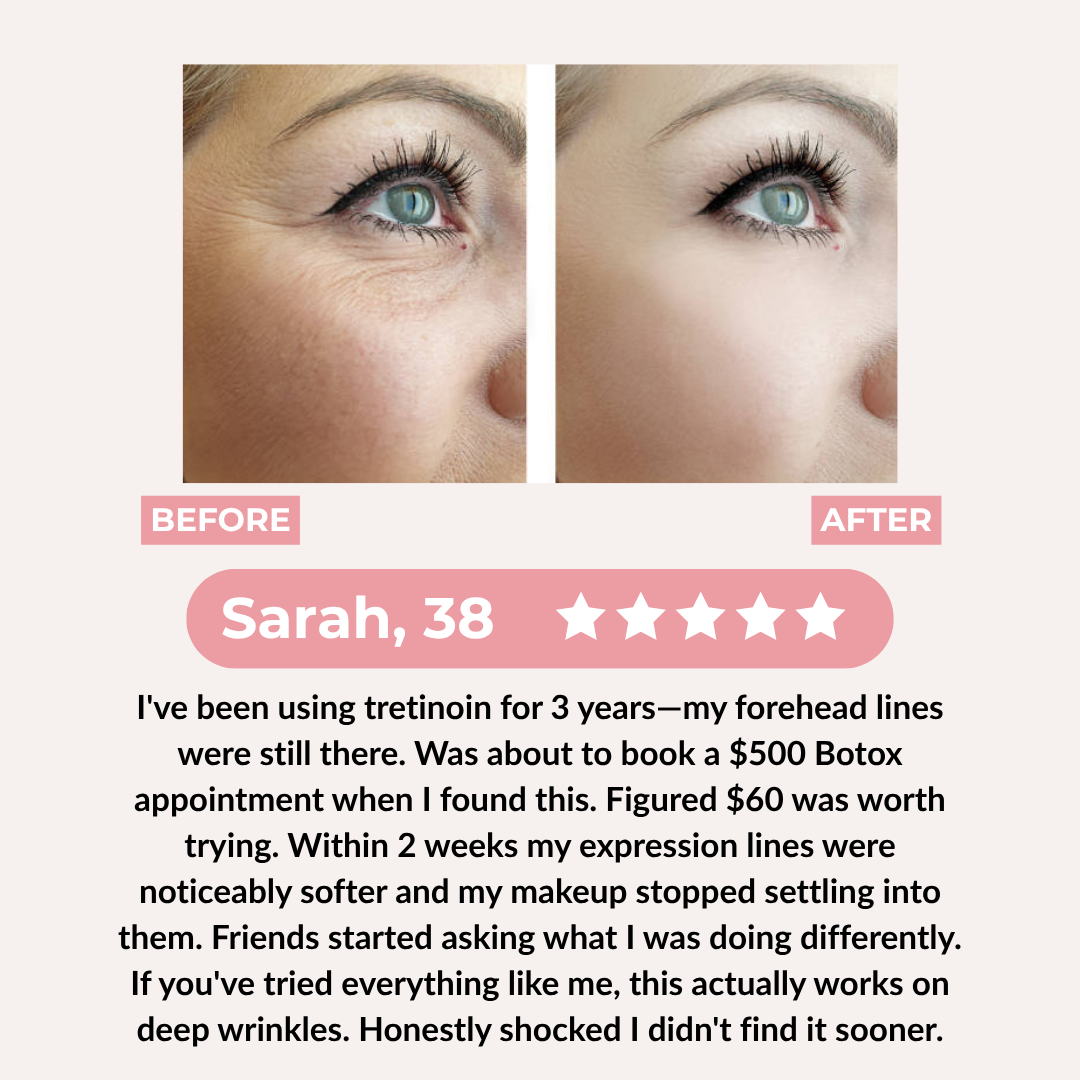 PDRN Pink Collagen Exosome Shot Anti Wrinkles & Fine Lines Serum