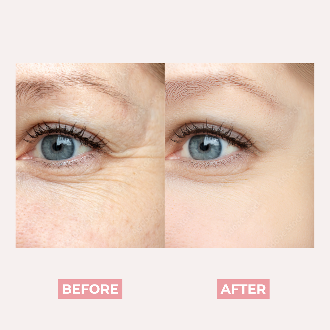 PDRN Pink Collagen Exosome Shot Anti Wrinkles & Fine Lines Serum