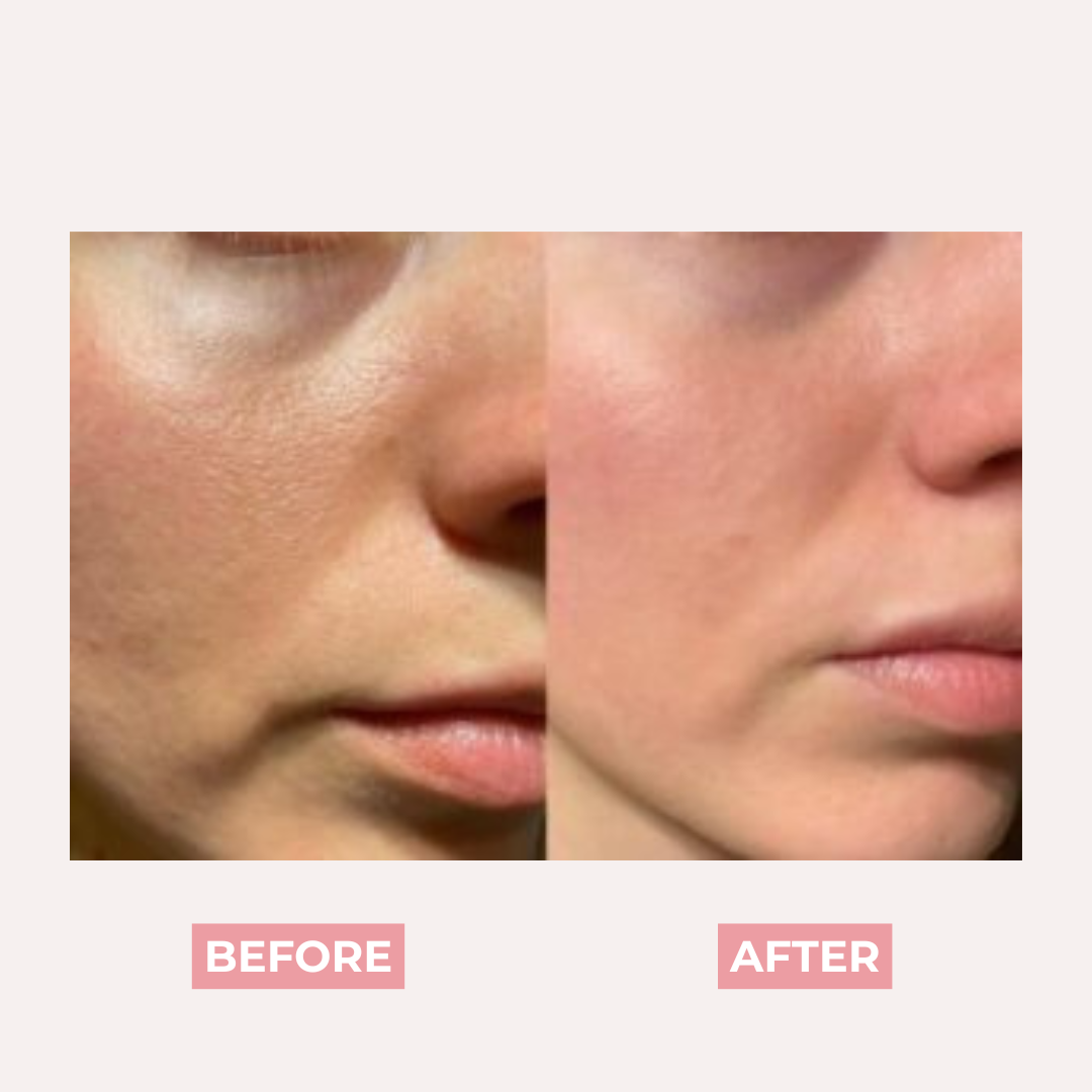 PDRN Pink Collagen Exosome Shot Anti Pores Serum