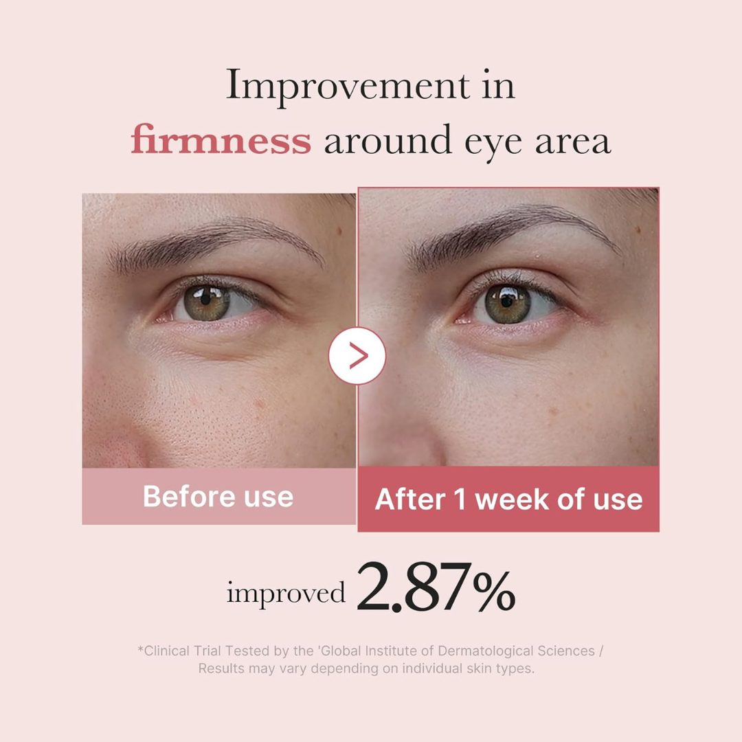 PDRN Eye Cream